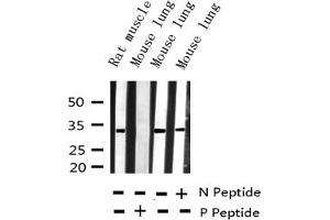 Western blot analysis of Phospho-BCL-XL (Ser62) expression in various lysates (BCL2L1 antibody  (pSer62))