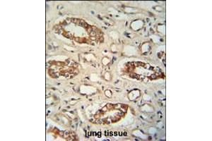 PPM1L antibody immunohistochemistry analysis in formalin fixed and paraffin embedded human lung tissue followed by peroxidase conjugation of the secondary antibody and DAB staining. (PPM1L antibody  (C-Term))