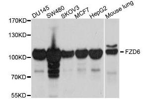 Western blot analysis of extracts of various cell lines, using FZD6 antibody. (FZD6 antibody  (AA 19-201))