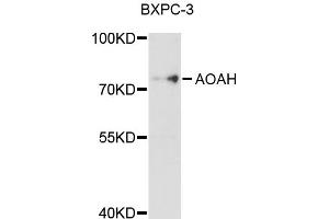 Western blot analysis of extracts of BxPC-3 cells, using AOAH antibody (ABIN4902917) at 1:1000 dilution. (AOAH antibody)