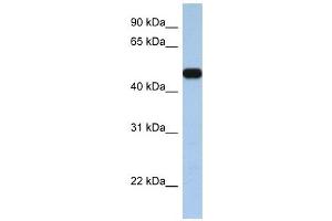 SLC25A46 antibody used at 1 ug/ml to detect target protein. (SLC25A46 antibody  (C-Term))