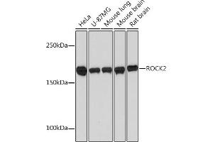 Western blot analysis of extracts of various cell lines, using ROCK2 Rabbit mAb (ABIN7269972) at 1:1000 dilution. (ROCK2 antibody)