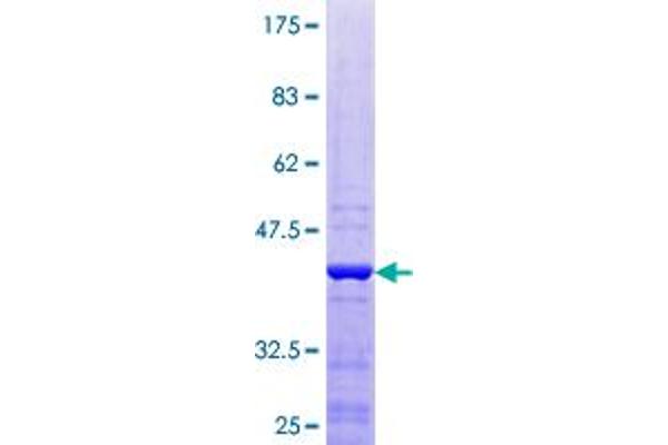 EIF1B Protein (AA 1-113) (GST tag)
