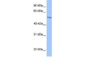 WB Suggested Anti-ETV5 Antibody Titration:  0. (ETV5 antibody  (N-Term))