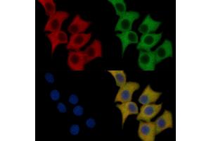 Flt3/CD135 Mouse Monoclonal Antibody staining HepG2 cells by IF/ICC.