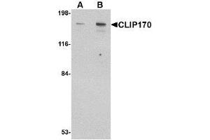 Image no. 1 for anti-CAP-GLY Domain Containing Linker Protein 1 (CLIP1) (C-Term) antibody (ABIN1492177) (CLIP1 antibody  (C-Term))