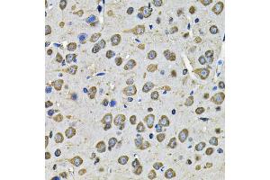 Immunohistochemistry of paraffin-embedded rat brain using PDIA6 Antibody (ABIN5974243) at dilution of 1/100 (40x lens).