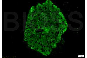 Formalin-fixed and paraffin embedded rat pancreas tissue labeled with Anti-Insulin Polyclonal Antibody, Unconjugated (ABIN724265) 1:200 followed by conjugation to the secondary antibody Goat Anti-Rabbit IgG, FITC conjugated used at 1:200 dilution for 40 minutes at 37°C. (Insulin antibody  (AA 46-59))