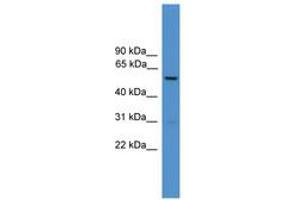 Image no. 1 for anti-Dopachrome Tautomerase (DCT) (AA 161-210) antibody (ABIN6745317) (DCT antibody  (AA 161-210))