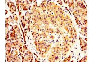Immunohistochemistry (IHC) image for anti-Carbonic Anhydrase II (CA2) (AA 2-260) antibody (ABIN7146715)