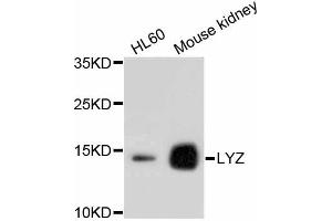 Western blot analysis of extracts of various cell lines, using LYZ antibody (ABIN4904274). (LYZ antibody)