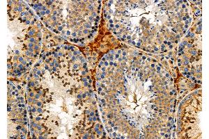 ABIN6259907 and ABIN6276919 at 1/100 staining Mouse testis tissue by IHC-P. (AMBP antibody  (C-Term))