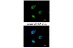 ICC/IF Image Immunofluorescence analysis of paraformaldehyde-fixed HeLa, using QIP1 , antibody at 1:200 dilution. (KPNA4 antibody  (C-Term))