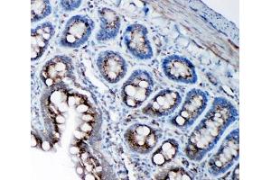 Immunohistochemistry (IHC) image for anti-Signal Sequence Receptor gamma (SSRg) (AA 8-23) antibody (ABIN3032563)