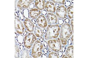 Immunohistochemistry of paraffin-embedded rat kidney using SNAPIN Rabbit pAb  at dilution of 1:200 (40x lens). (SNAPIN antibody  (AA 1-136))