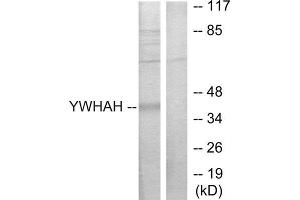 Western Blotting (WB) image for anti-14-3-3 eta (YWHAH) (Internal Region) antibody (ABIN1850145) (14-3-3 eta antibody  (Internal Region))