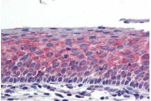 Human Tonsil: Formalin-Fixed, Paraffin-Embedded (FFPE) (KRT16 antibody  (AA 251-300))