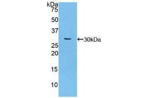 Western blot analysis of recombinant Mouse CA125. (MUC16 antibody  (AA 2-258))