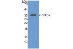 Detection of Recombinant SIRT2, Human using Polyclonal Antibody to Sirtuin 2 (SIRT2) (SIRT2 antibody  (AA 65-340))
