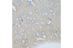 Immunohistochemistry of paraffin-embedded mouse brain using VSNL1 antibody. (VSNL1 antibody)