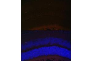 Immunofluorescence analysis of mouse retina using RDH5 Polyclonal Antibody (ABIN6130851, ABIN6146839, ABIN6146840 and ABIN6224076) at dilution of 1:100 (40x lens). (RDH5 antibody  (AA 24-318))