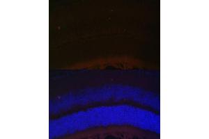 Immunofluorescence analysis of mouse retina using RDH5 Polyclonal Antibody (ABIN6130851, ABIN6146839, ABIN6146840 and ABIN6224076) at dilution of 1:100 (40x lens). (RDH5 antibody  (AA 24-318))
