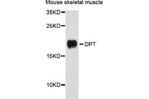 Western blot analysis of extracts of mouse skeletal muscle cells, using DPT antibody. (Dermatopontin antibody)