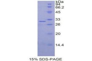 SDS-PAGE (SDS) image for Insulin-Like Growth Factor 2 mRNA Binding Protein 2 (IGF2BP2) (AA 141-384) protein (His tag) (ABIN1878252) (IGF2BP2 Protein (AA 141-384) (His tag))