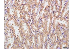 Paraformaldehyde-fixed, paraffin embedded rat kidney tissue, Antigen retrieval by boiling in sodium citrate buffer(pH6) for 15min, Block endogenous peroxidase by 3% hydrogen peroxide for 30 minutes, Blocking buffer (normal goat serum) at 37°C for 20min, Antibody incubation with Rabbit Anti-IGSF9 Polyclonal Antibody, Unconjugated  at 1:500 overnight at 4°C, followed by a conjugated secondary and DAB staining (IGSF9 antibody)