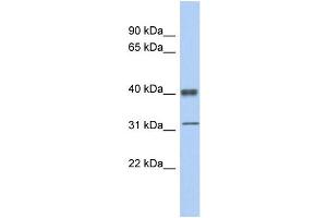 WB Suggested Anti-YBX1 Antibody Titration:  0. (YBX1 antibody  (Middle Region))