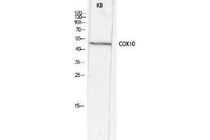 Western Blot (WB) analysis of KB lysis using COX10 antibody. (COX10 antibody  (Internal Region))