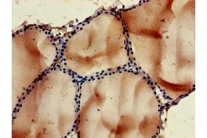 Immunohistochemistry of paraffin-embedded human thyroid tissue using ABIN7168384 at dilution of 1:100 (NOB1 antibody  (AA 103-229))