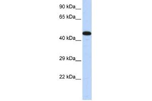 AKAP5 antibody used at 1 ug/ml to detect target protein.