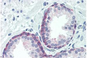 Immunohistochemistry (Paraffin-embedded Sections) (IHC (p)) image for anti-Forkhead Box O3 (FOXO3) (pThr24), (Thr32) antibody (ABIN461993)