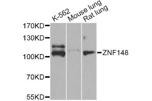 Western blot analysis of extracts of various cell lines, using ZNF148 Antibody (ABIN5974210) at 1/1000 dilution. (ZNF148 antibody)