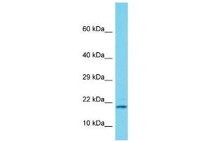 Host:  Rabbit  Target Name:  Supt4h1  Sample Type:  Rat Pancreas lysates  Antibody Dilution:  1. (SUPT4H antibody  (Middle Region))