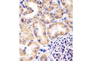 (ABIN6242389 and ABIN6578670) staining Hsp60 in human kidney tissue sections by Immunohistochemistry (IHC-P - paraformaldehyde-fixed, paraffin-embedded sections). (HSPD1 antibody  (AA 340-374))