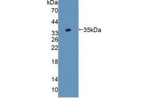 Detection of Recombinant AGXT2, Rat using Polyclonal Antibody to Alanine Glyoxylate Aminotransferase 2 (AGXT2) (AGXT2 antibody  (AA 225-512))