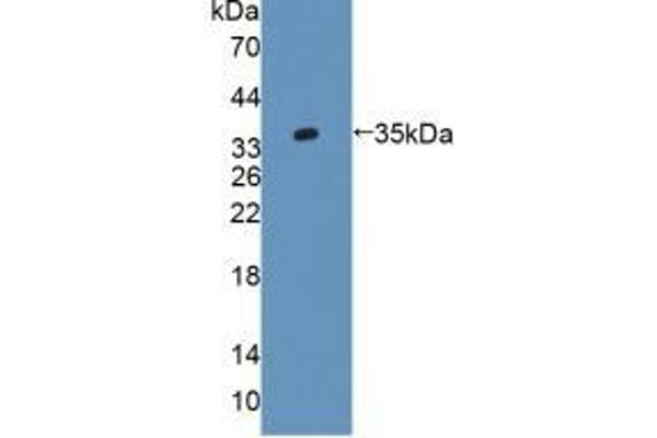 AGXT2 antibody  (AA 225-512)