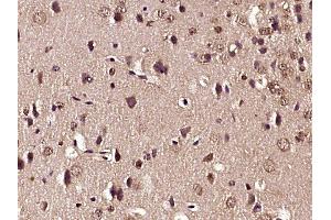 Paraformaldehyde-fixed, paraffin embedded mouse brain tissue, Antigen retrieval by boiling in sodium citrate buffer (pH6. (Glutamate Receptor 1 antibody  (pSer863))