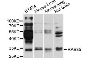 Western blot analysis of extracts of various cell lines, using RAB35 antibody (ABIN5995506) at 1/1000 dilution.