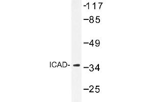 Image no. 1 for anti-DNA Fragmentation Factor, 45kDa, alpha Polypeptide (DFFA) antibody (ABIN272297)