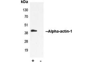 Immunoprecipitation of Alpha-actin-1 from 0. (Actin antibody  (N-Term))