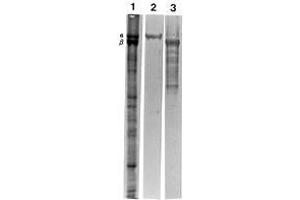 Western blotting polypeptides of ghosts of human erythrocytes (Lane 1, total protein profile) and reaction with MAb AF10 (Erythroid a-Spectrin)(Lane 2) and MAb DB2 (Erythroid b-Spectrin) (SPTA1 antibody)