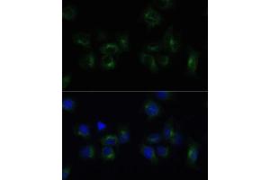 Immunofluorescence analysis of HeLa cells using CLTB Polyclonal Antibody (ABIN6131587, ABIN6138750, ABIN6138751 and ABIN6224454) at dilution of 1:100 (40x lens).