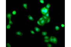 Immunofluorescence staining of HepG2 cells with ABIN7173357 at 1:166, counter-stained with DAPI. (TRIB1 antibody  (AA 3-91))