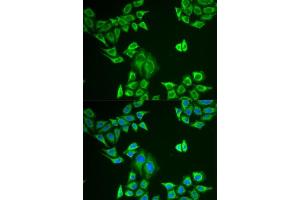 Immunofluorescence analysis of U2OS cells using MLANA antibody. (MLANA antibody  (AA 48-118))