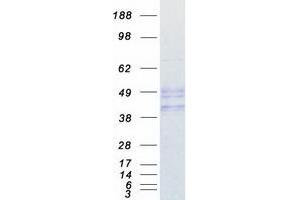 Validation with Western Blot