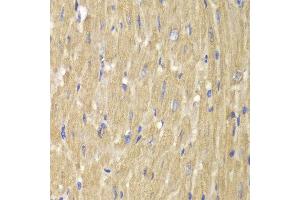 Immunohistochemistry of paraffin-embedded mouse heart using NCF2 antibody at dilution of 1:100 (400x lens). (NCF2 antibody)