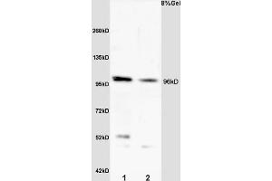 L1 rat heart lysate L2 rat kidney lysates probed with Anti VLDL Polyclonal Antibody, Unconjugated (ABIN705551) at 1:200 overnight at 4 °C. (VLDLR antibody  (AA 551-650))